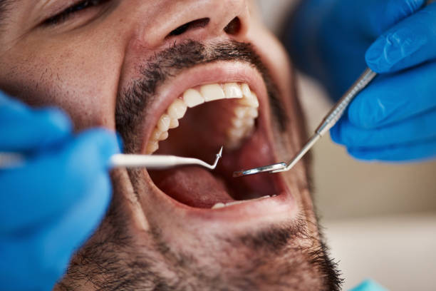 Best Urgent Tooth Repair  in Craigsville, WV